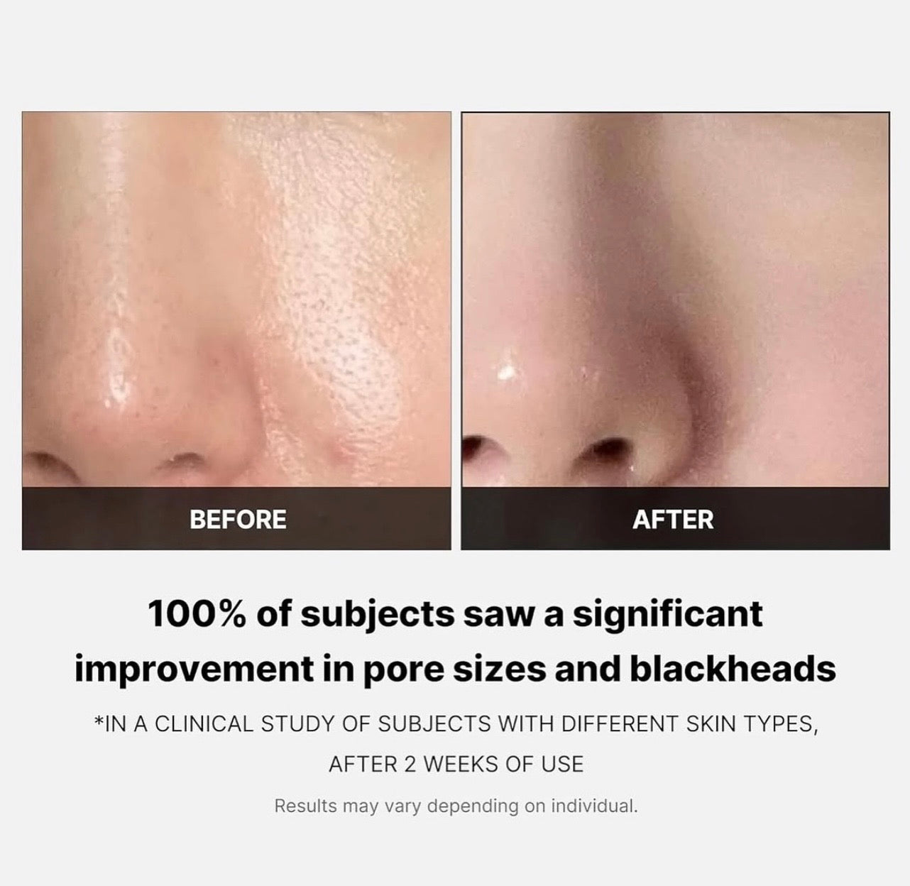 Medicube Zero Pore Pads 2.0 — 70 Pads (155g)